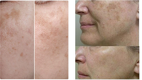before and after image